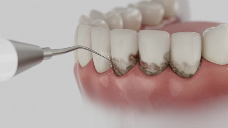 Reliable Tooth Extraction contractor in Tchula, MS by Smile Center Dentistry